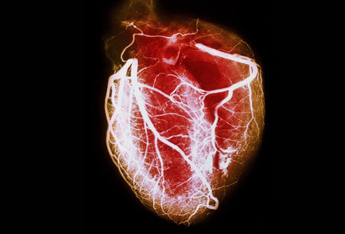 PRinc_rm_arteriogram_of_healthy_heart.jpg